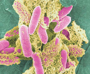 22 deaths in Europe by E.Coli