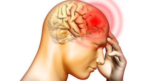 Πονοκέφαλος: Μάθετε ασυνηθιστους λόγους που τον προκαλούν